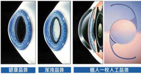 ҕg(sh)ע@cҕg(sh)Ч@