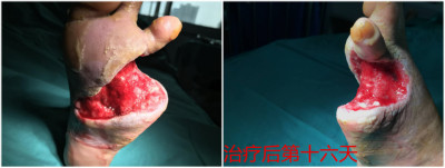 5(j)Fݰ`ǌͨj(lu)(chung)조E