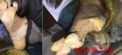 5(j)Fݰ`ǌͨj(lu)(chung)조E