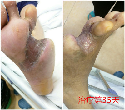 5(j)Fݰ`ǌͨj(lu)(chung)조E