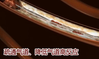 t(y)Ժѣl(f)Ҳep