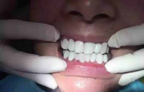 ׌˼(x)˼Oֵı{N桢6Dɵ˲\