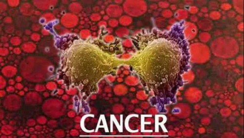 ȫ󰩰Yy(tng)Ӌ(j)(bo)tYĎx