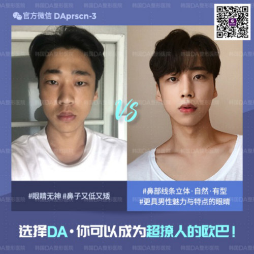 nDAt(y)Ժ۱g(sh)ע(xing)