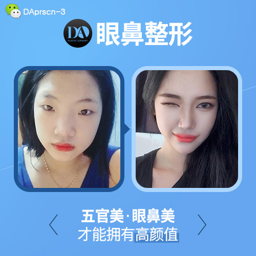 nDAt(y)Ժ۱g(sh)ע(xing)