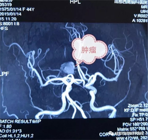 ɶXt(y)ԺO(sh)䣺t(y)ġ͸ҕۡ3.0T˴Ź