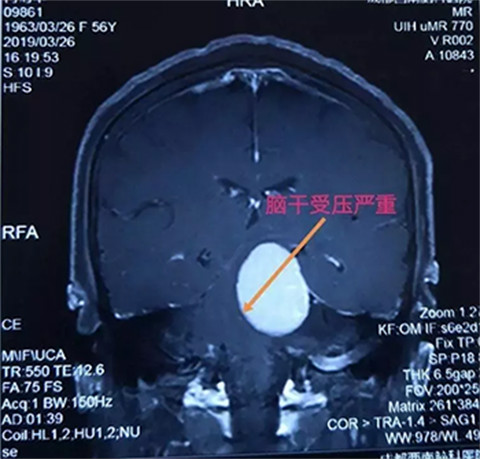 ɶXt(y)ԺO(sh)䣺t(y)ġ͸ҕۡ3.0T˴Ź