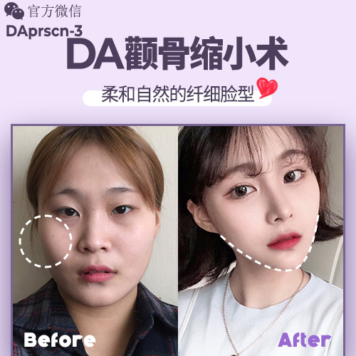 n(gu)DAEǿsСg(sh)_(ki)θ@Ę݆|(zh)