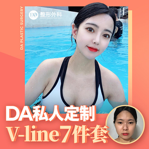 【韓國(guó)DA顴骨縮小】截骨越多并不代表更美麗
