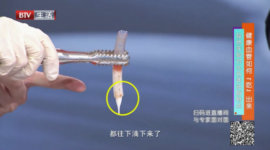 《全民健康學(xué)院》邀您一同解讀磷蝦油的健康密碼